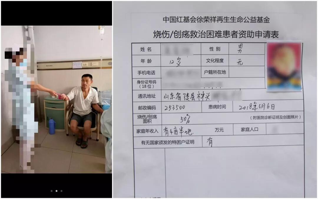 9170金沙集团_父亲聋哑母亲智障 脑瘫儿童烫伤引发“爱心潮”