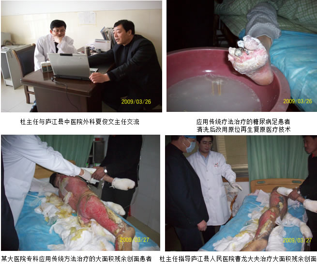 9170金沙集团_皮肤原位再生回复医疗手艺在皖南普及
