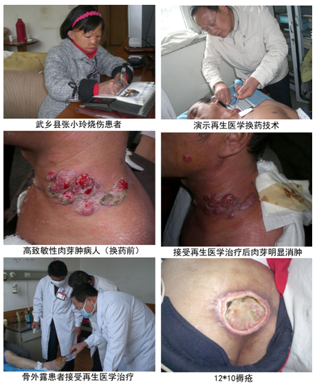 9170金沙集团_再生医学手艺在晋南晋东南地区着花效果