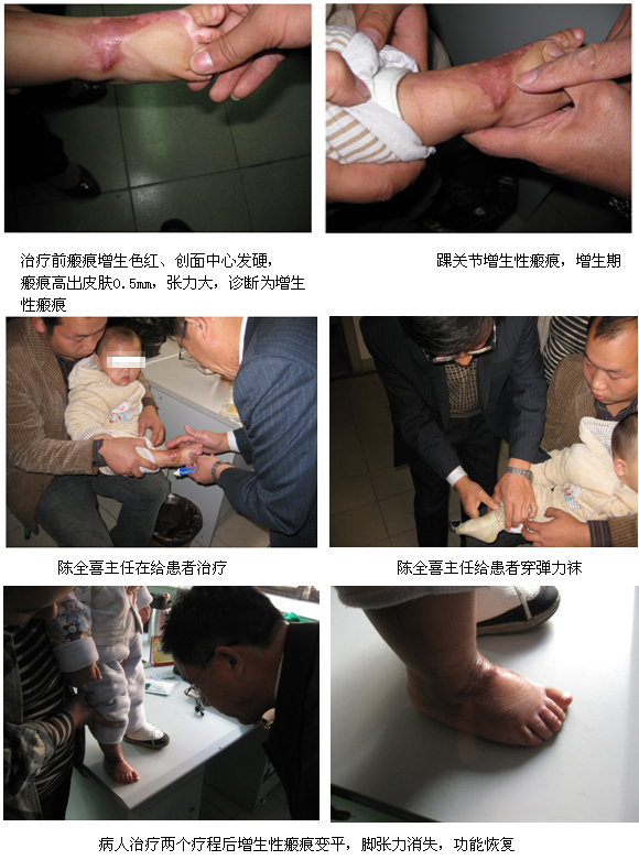 9170金沙集团_再生回复医疗手艺修复体表瘢痕