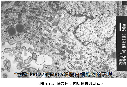 9170金沙集团_破解人体生命再生延续之谜（二）