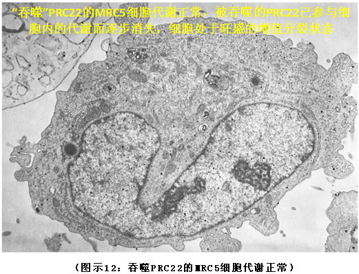 9170金沙集团_破解人体生命再生延续之谜（二）