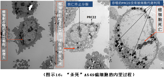 9170金沙集团_破解人体生命再生延续之谜（二）