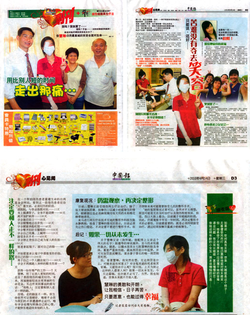 9170金沙集团_不幸女孩的再生事业使烧伤再生疗法享誉马来