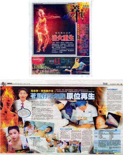 9170金沙集团_不幸女孩的再生事业使烧伤再生疗法享誉马来