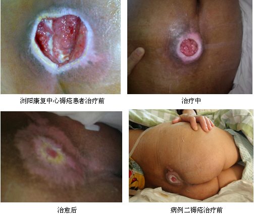 9170金沙集团_心系工伤患者康复 彰显大爱无限真情