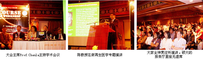 9170金沙集团_烧伤再生医学在印尼天下烧伤大会上大放色泽