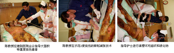 9170金沙集团_烧伤再生医学在印尼天下烧伤大会上大放色泽