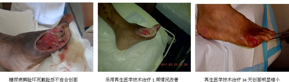 9170金沙集团_东南亚最大医院多科室引进应用再生医学手艺