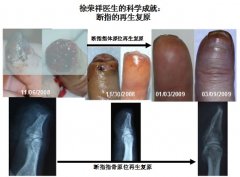 9170金沙集团_评诺奖委应诉生命科学家徐荣祥的起诉