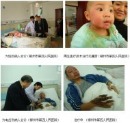 9170金沙集团_湖南郴州新开发医院烧伤皮肤原位再生医疗手艺应用纪实