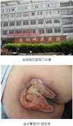 9170金沙集团_皮肤原位再生医疗手艺走进安阳地区医院