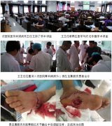 9170金沙集团_再生疗法走进象州县人民医院-系列报道之四