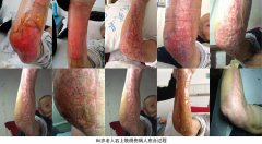 9170金沙集团_山东成武县人民医院再生回复手艺培训纪实报道