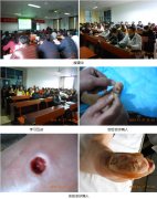 9170金沙集团_再生医疗手艺作为湖南省农村与城镇社区卫生相宜手艺