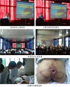 9170金沙集团_烧伤创疡再生医学与疗法走进绥阳县中医院