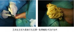 9170金沙集团_专家指导再外行艺操作规范让临床治疗困局“迎刃而解”