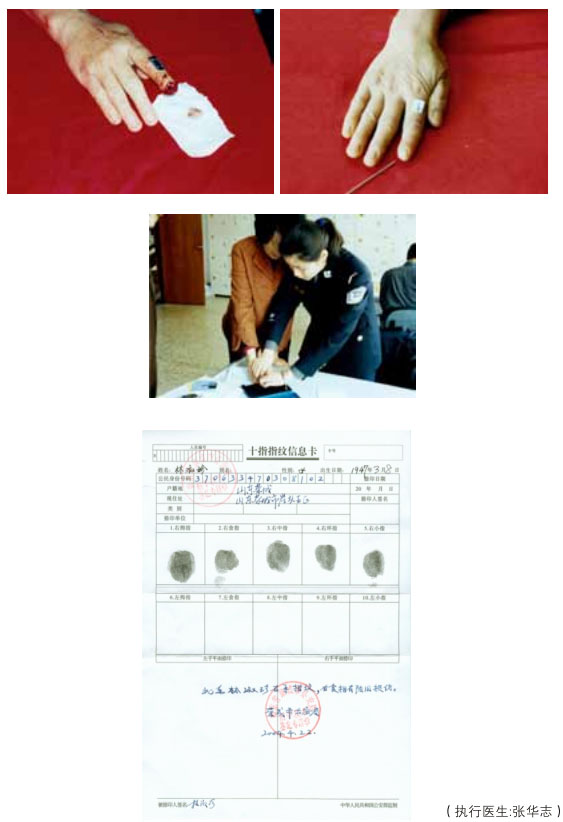 9170金沙集团_二、断指的再生回复