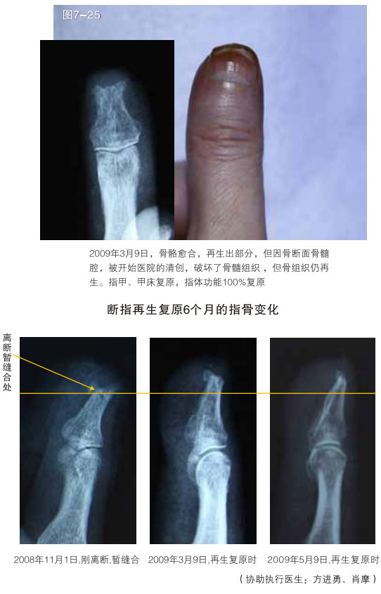 9170金沙集团_二、断指的再生回复