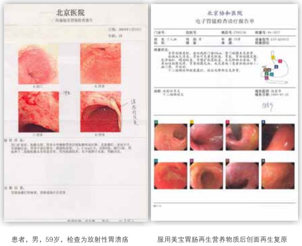 9170金沙集团_六、胃肠粘膜的原位再生回复
