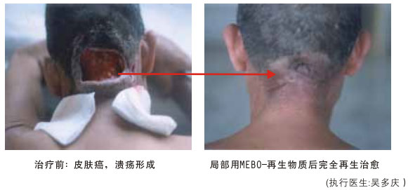 9170金沙集团_八、再生抗癌的研究