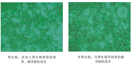 9170金沙集团_八、再生抗癌的研究