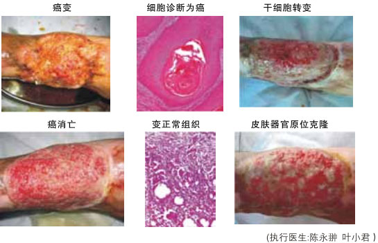 9170金沙集团_八、再生抗癌的研究