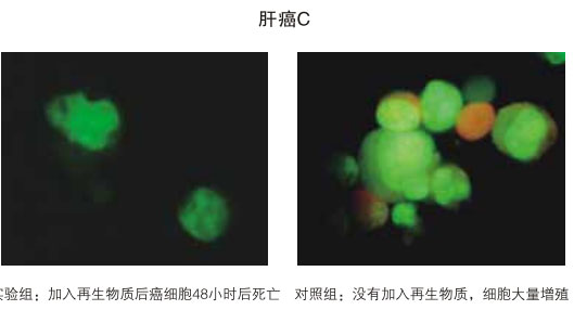 9170金沙集团_八、再生抗癌的研究