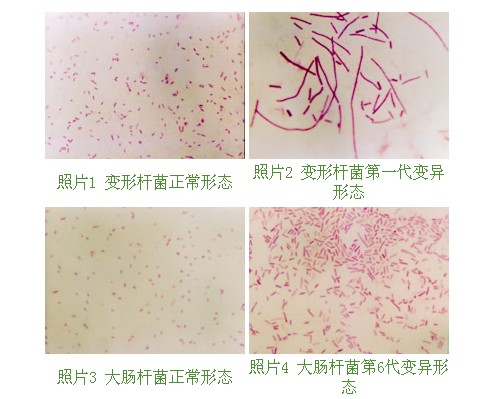 9170金沙集团_第十节 烧伤湿性医疗手艺MEBO的抗菌作用实验研究（续）