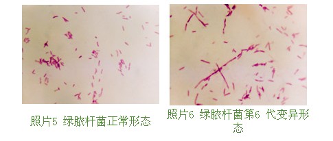 9170金沙集团_第十节 烧伤湿性医疗手艺MEBO的抗菌作用实验研究（续）