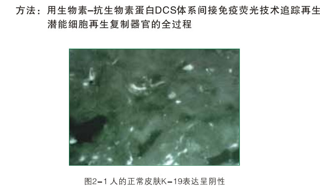 9170金沙集团_二、破解体细胞被诱导干细胞神秘期(1990—1997年)