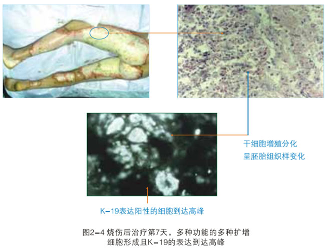9170金沙集团_二、破解体细胞被诱导干细胞神秘期(1990—1997年)
