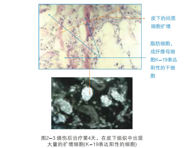 9170金沙集团_二、破解体细胞被诱导干细胞神秘期(1990—1997年)