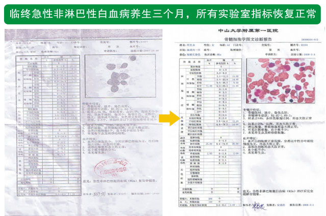 9170金沙集团_七、癌症的神秘以及癌症与再生物质的关系