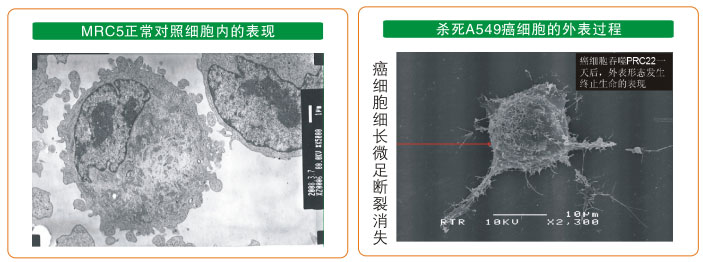 9170金沙集团_七、癌症的神秘以及癌症与再生物质的关系