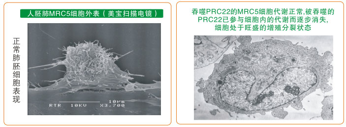 9170金沙集团_七、癌症的神秘以及癌症与再生物质的关系