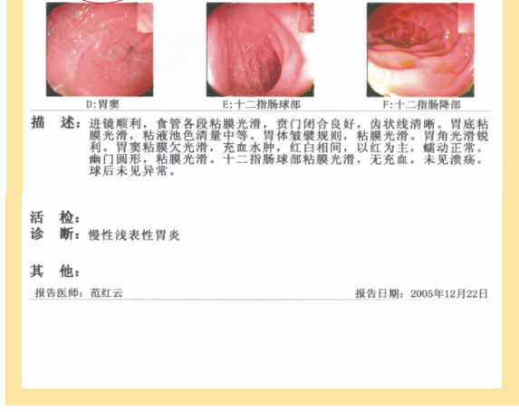9170金沙集团_七、临床验证