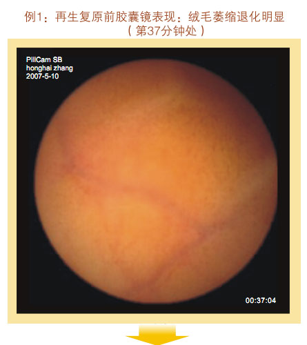 9170金沙集团_七、临床验证
