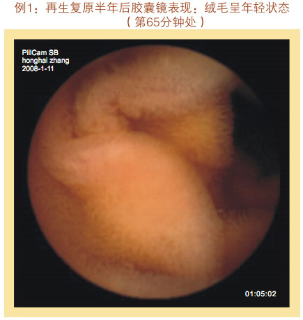 9170金沙集团_七、临床验证