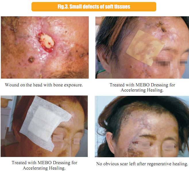 9170金沙集团_1  Regenerative recovery of traumas