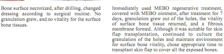9170金沙集团_1  Regenerative recovery of traumas