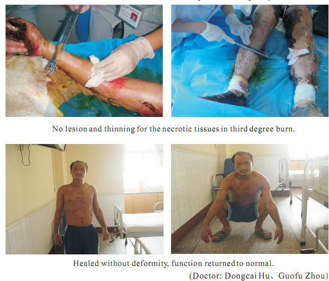 9170金沙集团_1  Regenerative recovery of traumas