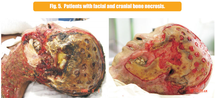 9170金沙集团_1  Regenerative recovery of traumas