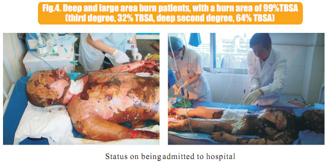9170金沙集团_1  Regenerative recovery of traumas