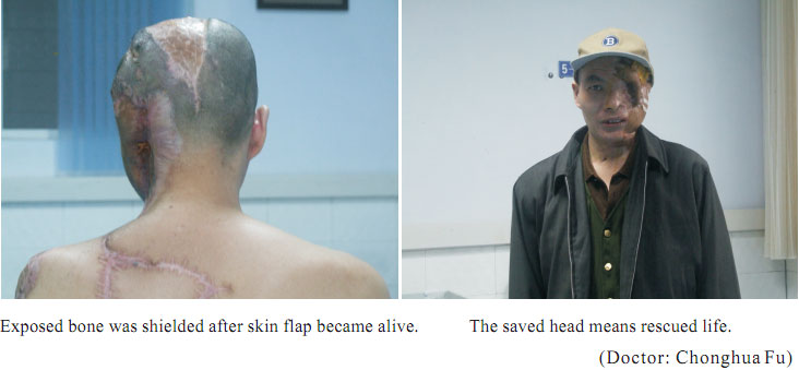 9170金沙集团_1  Regenerative recovery of traumas
