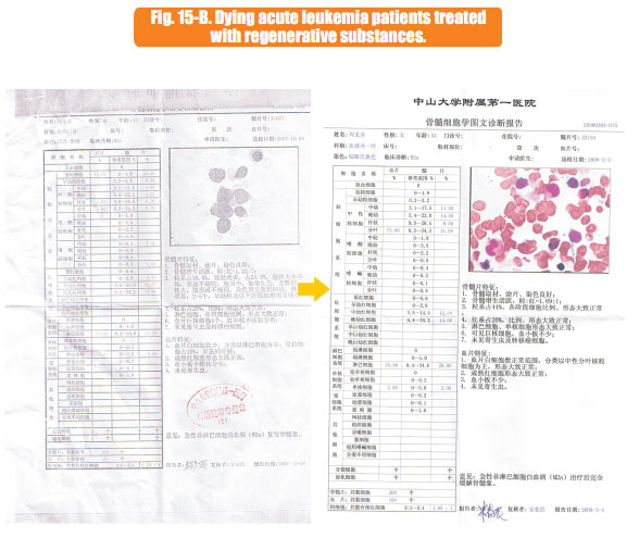 9170金沙集团_7  In situ regenerative restoration of multiple organs