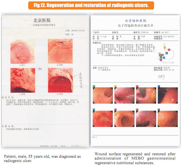 9170金沙集团_6  In situ regenerative restoration of gastrointestinal muco