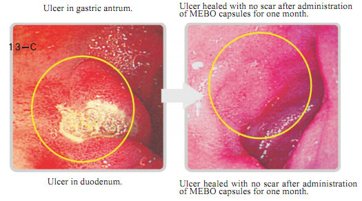 9170金沙集团_6  In situ regenerative restoration of gastrointestinal muco