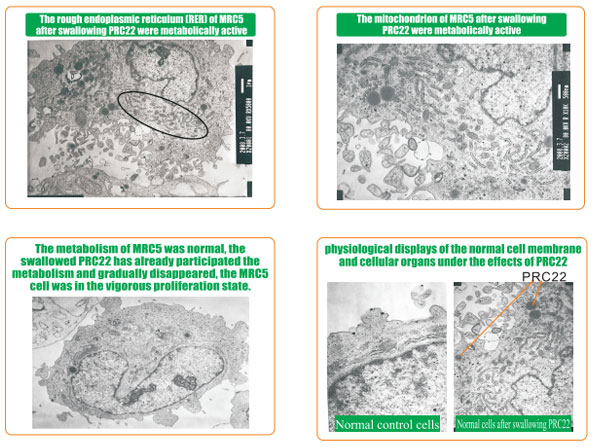 9170金沙集团_8  Research on rResearch on regenerative anti-cancer