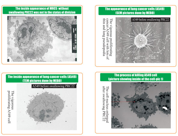 9170金沙集团_8  Research on rResearch on regenerative anti-cancer
